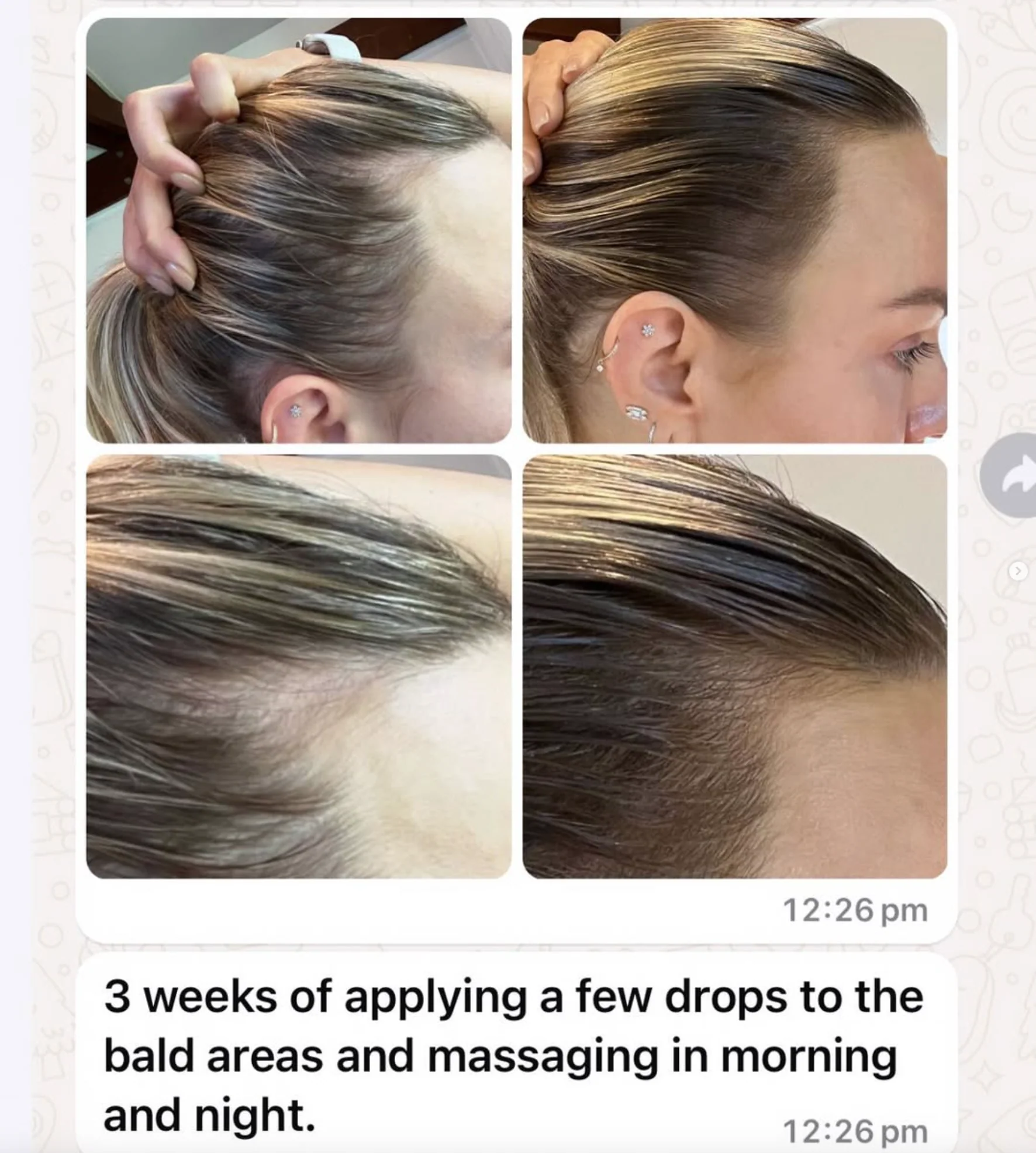Vita-Growth Peptide Scalp Serum - Image 3